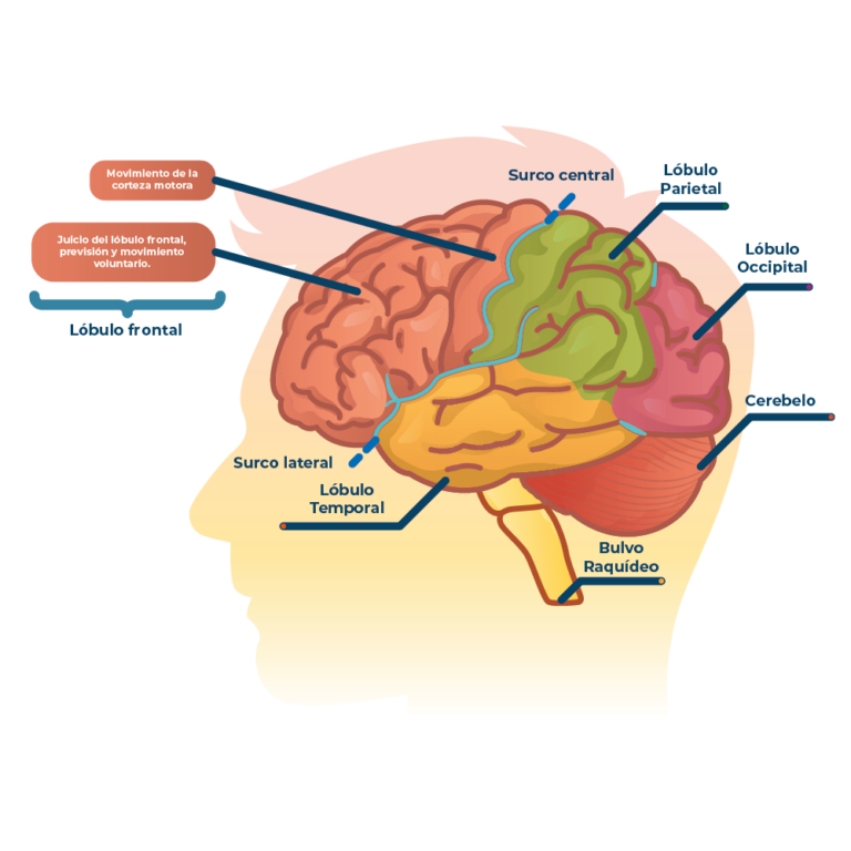 ¿QUÉ CAUSA LA PARÁLISIS CEREBRAL?