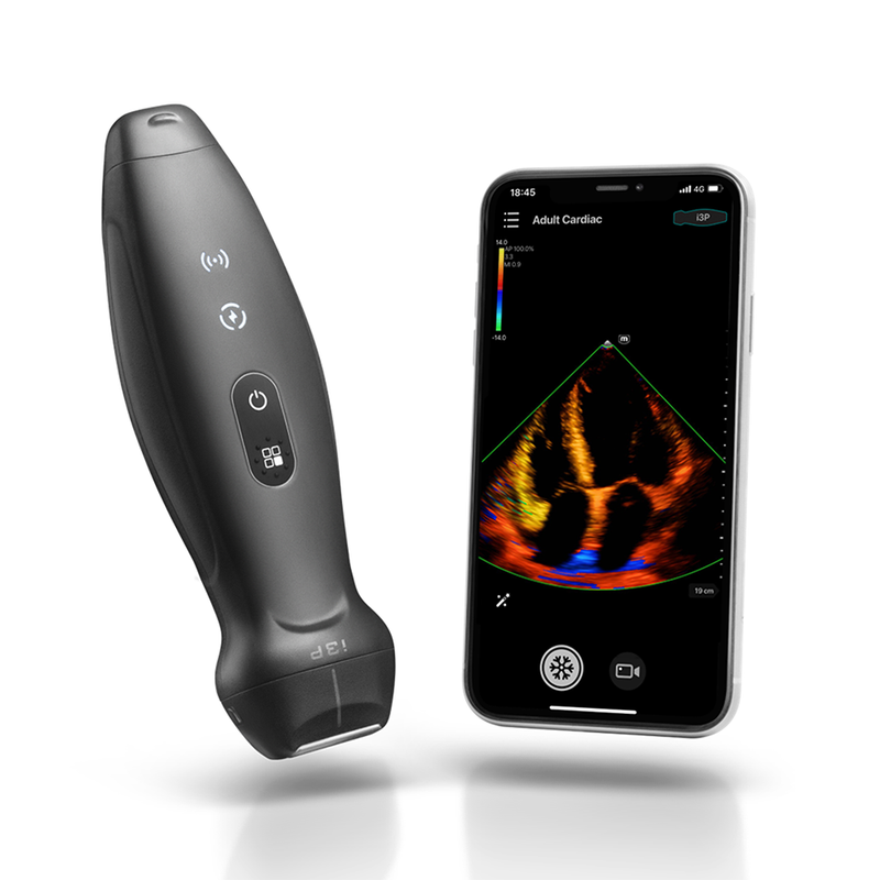 Equipo de Ultrasonido Portátil Inalámbrico TE Air