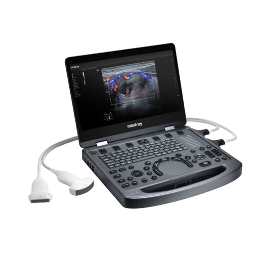 Equipo de Ultrasonido MX3 - Casa Medica