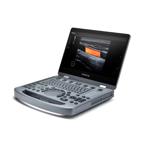 Equipo de Ultrasonido MX3 - Casa Medica