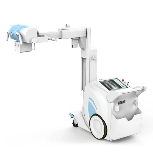 Rayos - X Digital Portátil MobileSparkler - Casa Medica